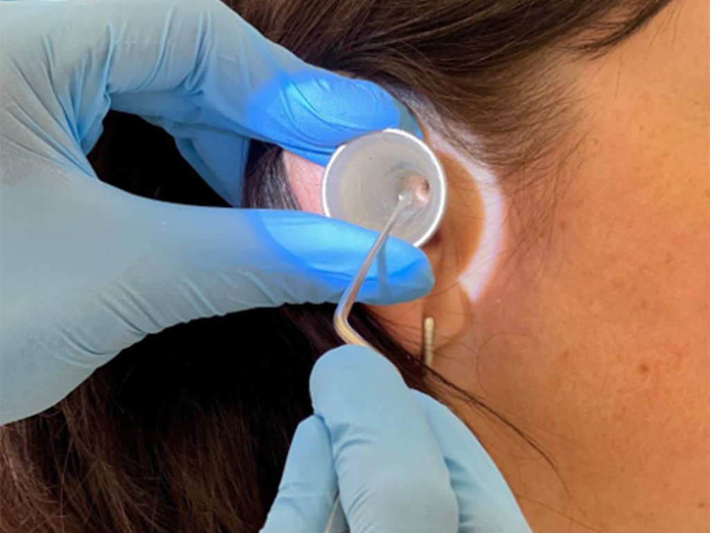 Гной в ухе — когда стоит искать опухоль?